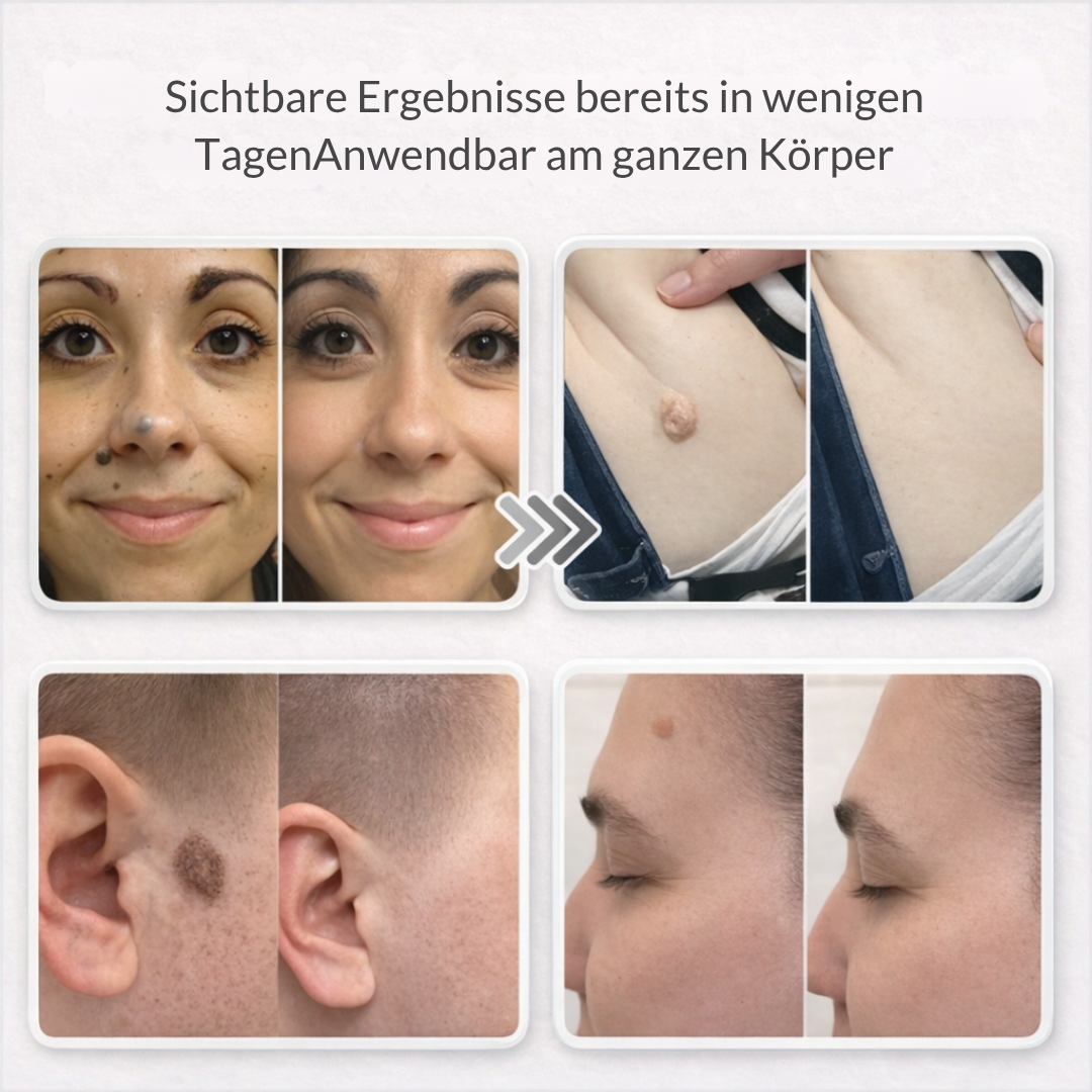 Lovera Care - Hautpflaster