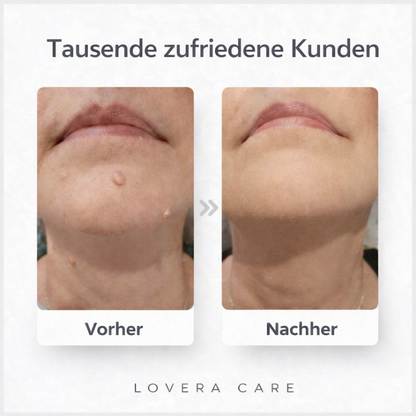 Lovera Care - Hautpflaster