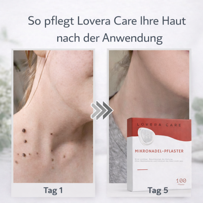 Lovera Care - Hautpflaster