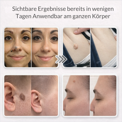 Lovera Care - Hautpflaster